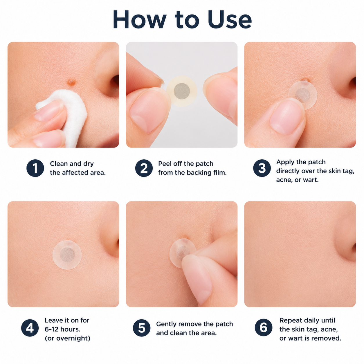 ✨Diufar®2-in-1 Microneedle & Hydrocolloid Patch🍀| Removes Raised Moles, Acne, Flat Warts & Skin Tags | Helps Improve Wrinkles, Scars & Blemishes | Invisible Patches for Face & Body